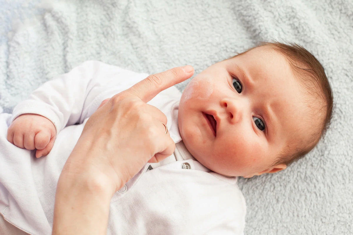 crème hydratante sur la peau sèche de bébé